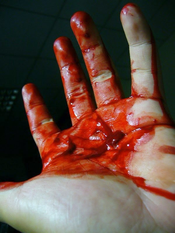 Bloody_Hand.jpg