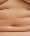 0119-belly-rolls-fat_at.jpg