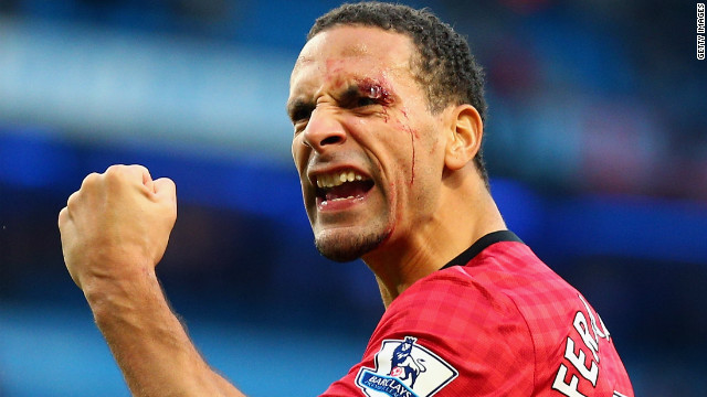 121213012505-rio-ferdinand-cut-face-horizontal-gallery.jpg