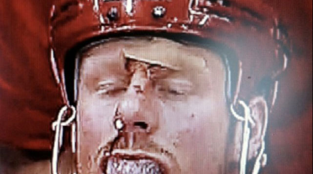 franzen-face.jpg