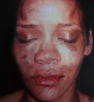 _rihanna_beaten_face.jpg