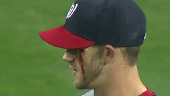 dm_120511_bryce_harper_eye.jpg